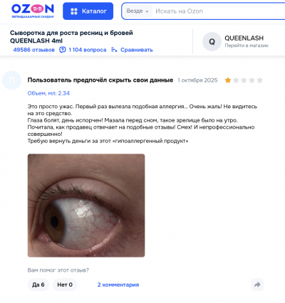 Queenlash отзывы: цирк иллюзий и реальность последствий